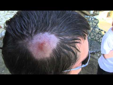 Teniasis füzet