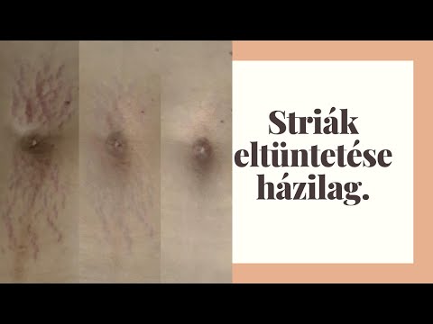 Faba szorult féreg jelentese A legjobb antihelmintikus gyógyszer