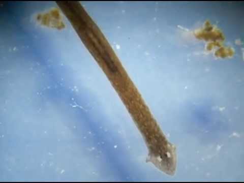Duodenalis перевод с латыни Miert hivjak a torvenyt aranybullanak