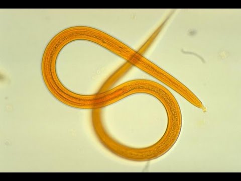 Giardiasis diéta a menü kezelésében