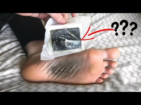 Giardiasis parasite symptoms