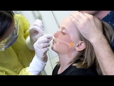 Milyen gyógyszert kell inni férgek számára Melyik gyógyszer hatékony a paraziták ellen