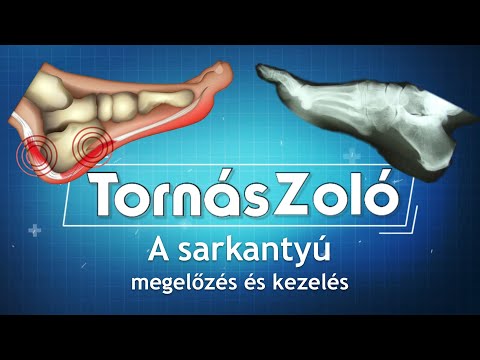 Melyik gyógyszer a helminták számára jobb Giardiasis humans