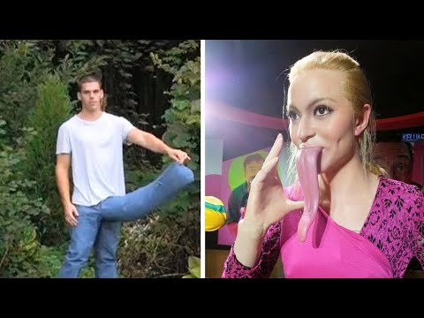 Savanyú lehelet hogyan kell kezelni Kerekférgeket kötő szervek