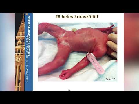 Enterobiosis kerítés