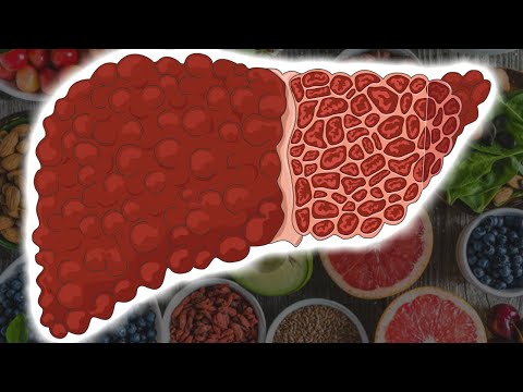 Platyhelminták ootípusa Parazita betegségek kezelése