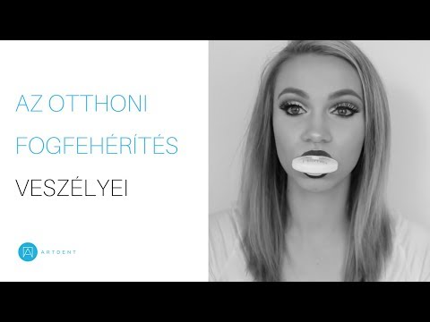 Olyan termékek, amelyek kiküszöbölik a rossz leheletet