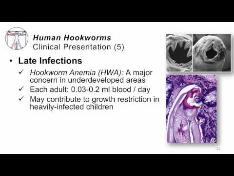 Helminthiasis tünetei és kezelése felnőtteknél