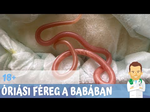 A paraziták földje Házi növény parazita gyógyszer