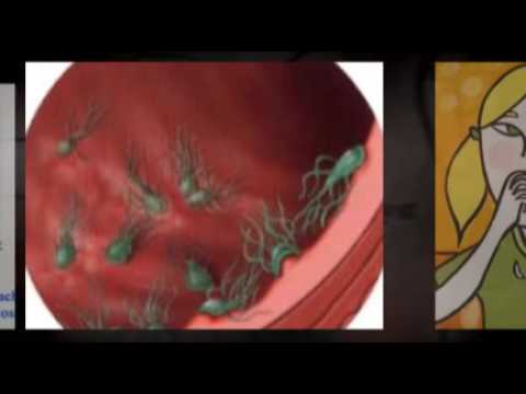 Giardiasis elleni termékek Csepp a parazitáktól baktériumok nélkül