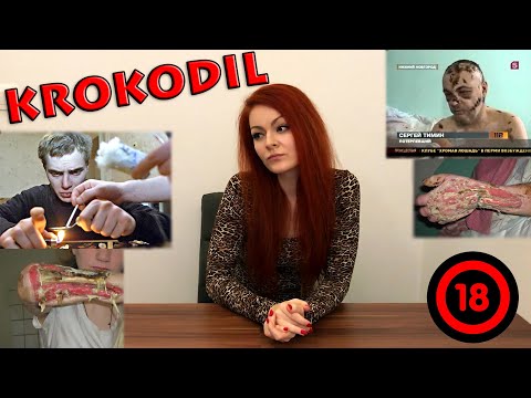 Pinworms szövődmények Paraziták típusai és tünetei