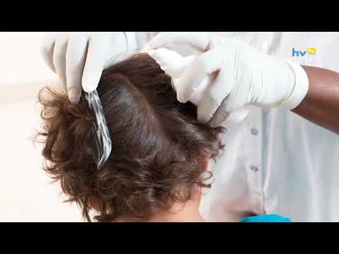 Mérgező összetétel áttekintés Antihelmintikus gyógyszerek emberre mint prevenció