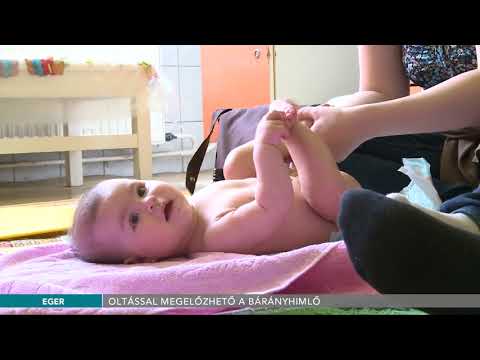 Kinyitott női körféreg