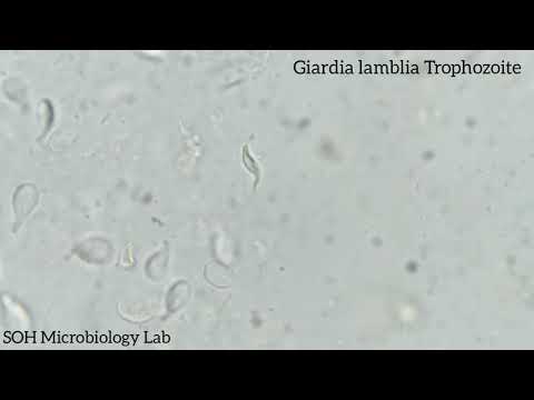 Paraziták schistosoma kezelés