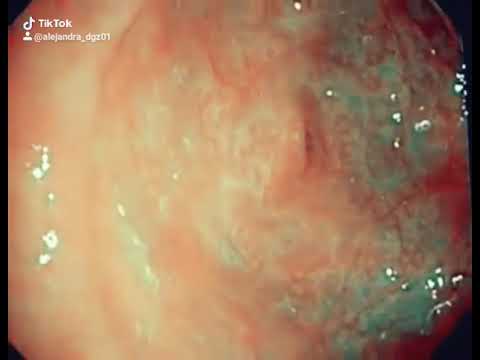 Giardia canis