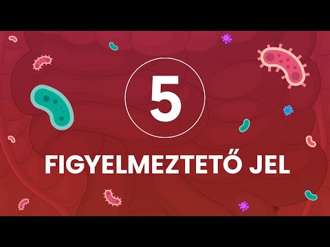 Bika lánc fejlesztési folyamat