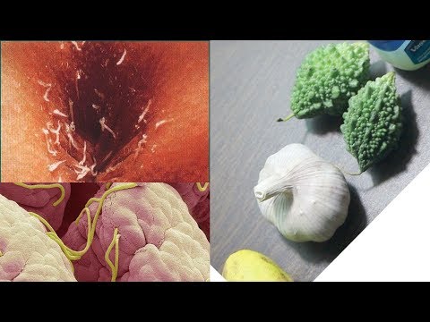 Hogyan kell kezelni a pinworms- t felnőtteknél