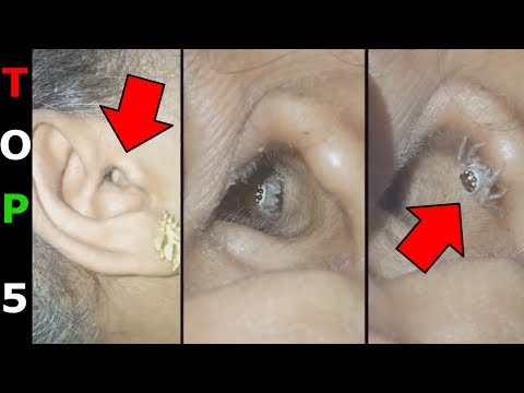 Paraziták diagnosztizálása és kezelése