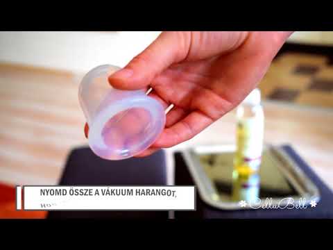 Az emberi test parazitáit kezelő orvos
