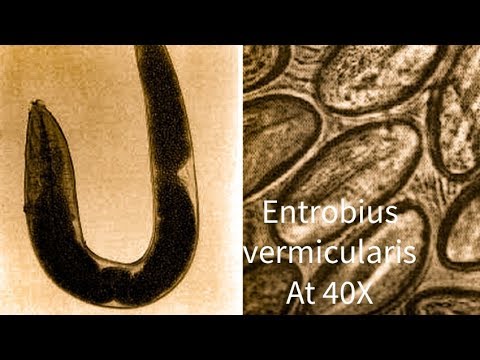 Az enterobiasis kezelésének ellenőrzése