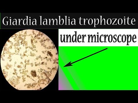 Férgek típusú férgek férfiak gyógyszerek