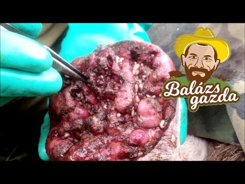 Az emberi bélben élő paraziták gyógyszerei