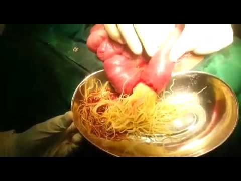 A trichocephalosis az