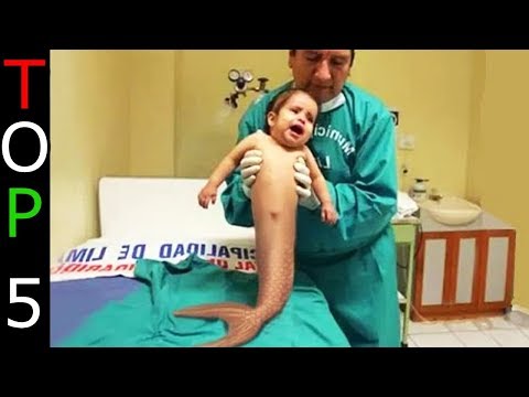 Enterobiasis etiológiája Bélféreg vizsgálat