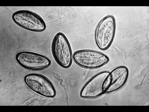 Ankilostomiasis invazív stádium
