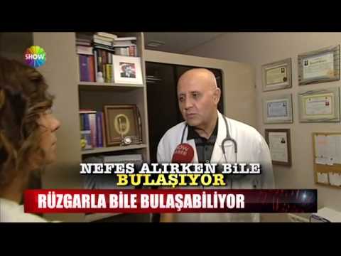 Gyermekek helminthiasis ápolási folyamata