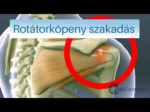 Aszcariasis a fő tünet